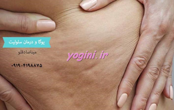 تصویر حرکات یوگا برای داشتن پوست صاف و شفاف